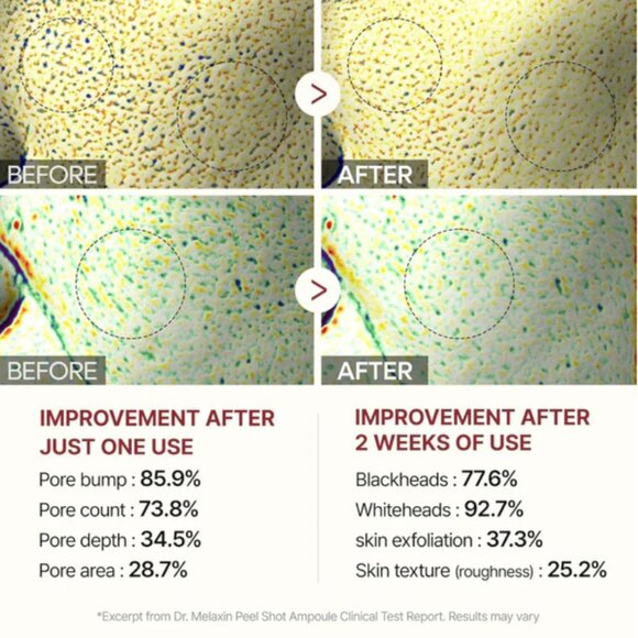 Dr. Melaxin Black Rice Peel Shot + Facial Scrubber - Picture 5 of 7